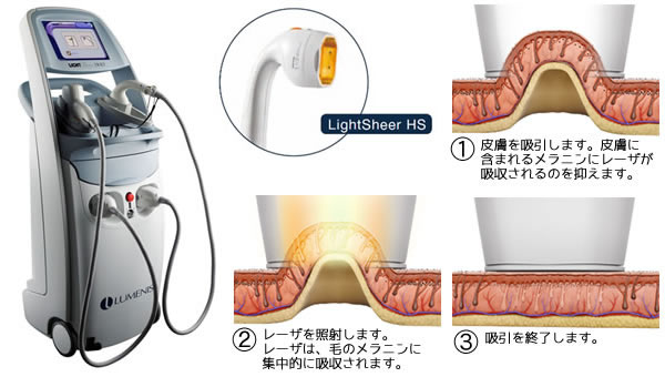ライトシェア デュエット